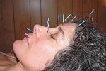 Click image for larger version

Name:	Acupuncture%20for%20Sinuses.jpg
Views:	252
Size:	40.1 KB
ID:	97997