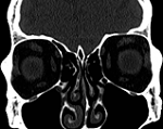 Click image for larger version

Name:	MySkull.png
Views:	284
Size:	26.9 KB
ID:	129954