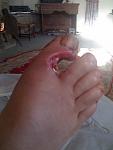 Click image for larger version

Name:	Foot_After.jpg
Views:	224
Size:	20.5 KB
ID:	139637
